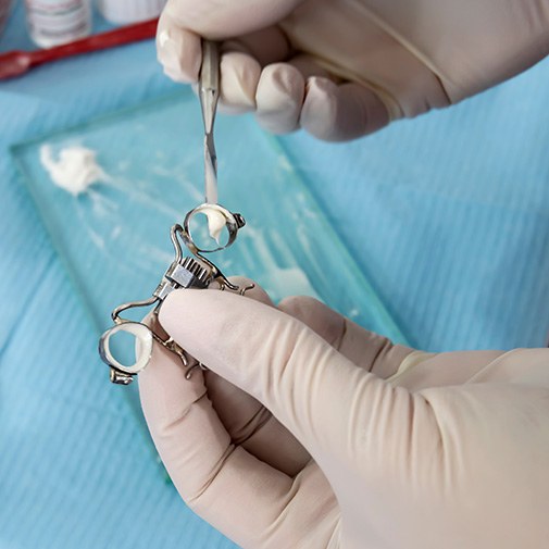 Close-up of Hyrax expander on dental model in Mt. Vernon
