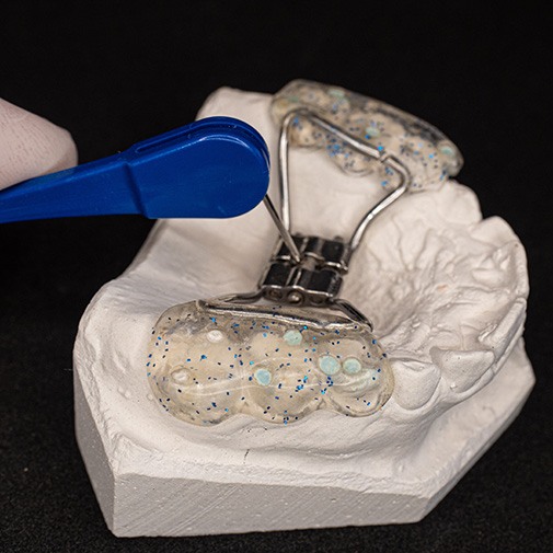 Parent adjusting Hyrax expander with key in Heath