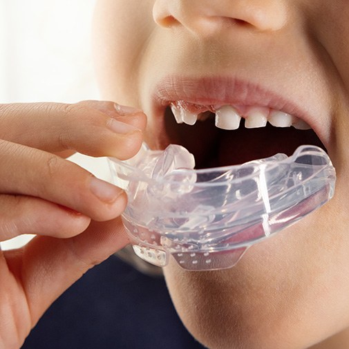 Child putting in mouthguard for Phase 1 orthodontics 