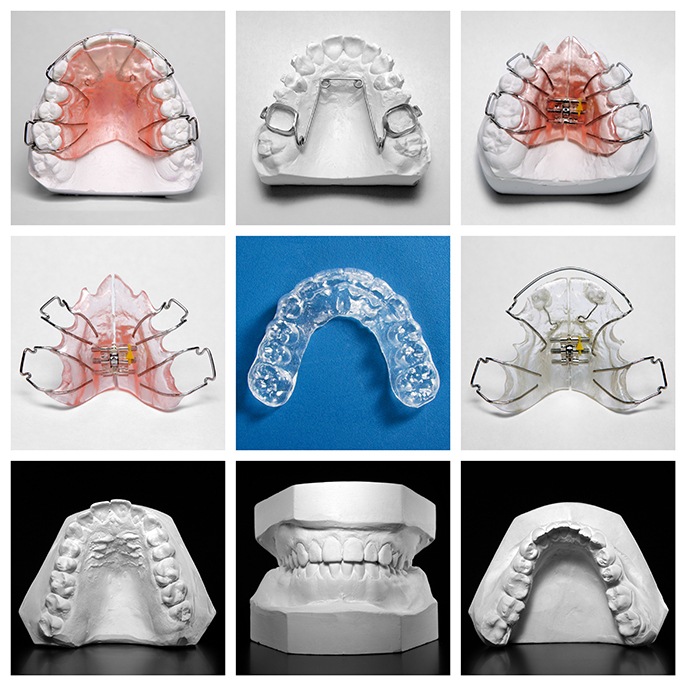 Retainers are devices designed to maintain your orthodontic results