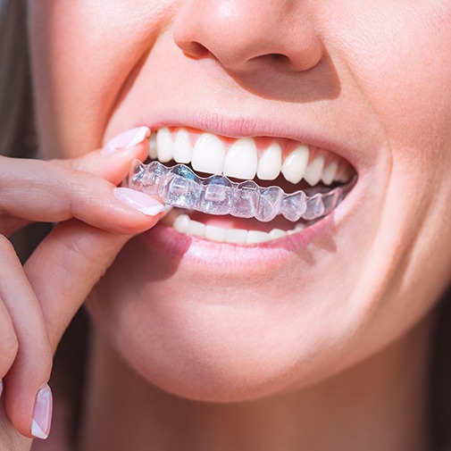 retainers are devices designed to maintain the position of your teeth