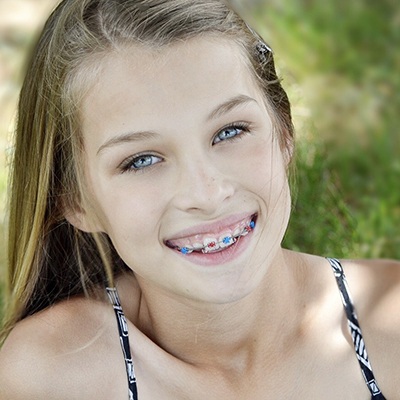 Young girl with red and blue braces brackets