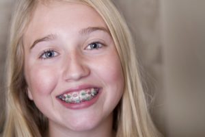 A smiling girl with braces. 