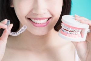 Woman holding braces and clear trays