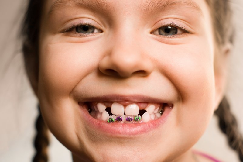 Little girl wearing braces smiling.