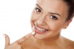 woman smiling wearing metal braces