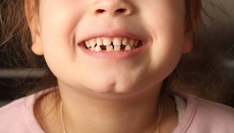 Little girl with gapped bottom teeth.