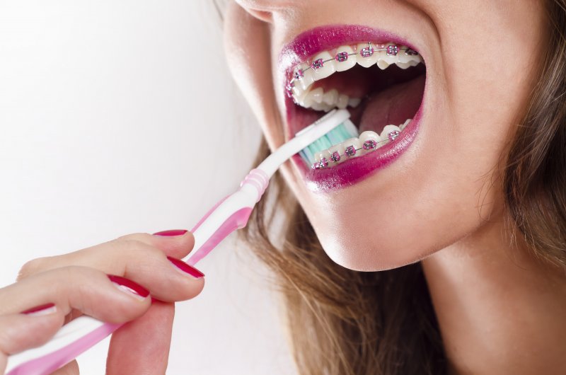 Do You Need to Get Your Wisdom Teeth Removed Before Braces?