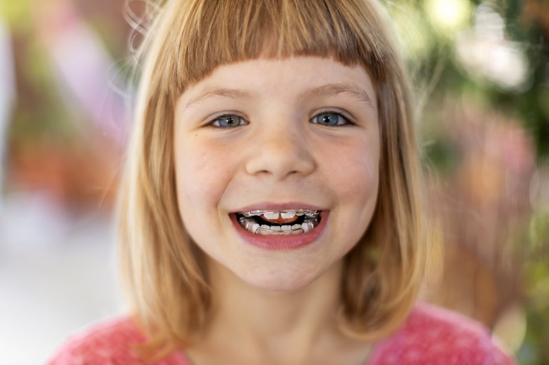 Young girl smiling wearing braces placed by orthodontist.