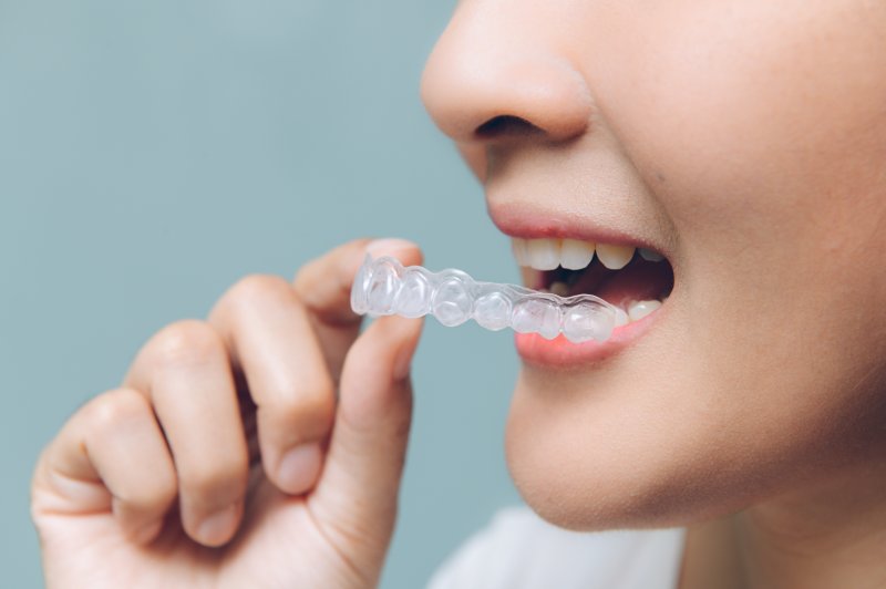 holding Invisalign aligner near mouth.