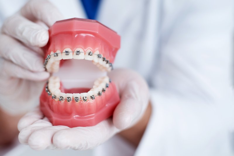 Orthodontist holding up model of teeth with braces